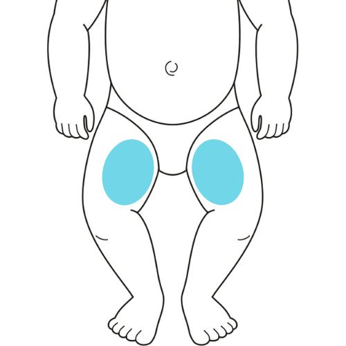 Hohe 1 beim Baby an der Innenseite der Oberschenkel